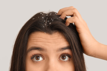Naklejka premium Young woman with dandruff problem on white background, closeup