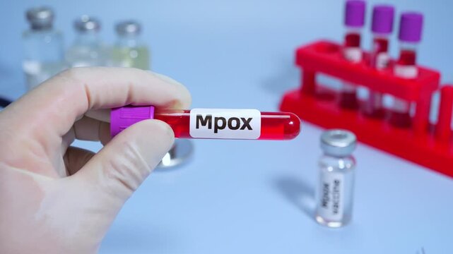 Blood collection tubes Mpox test positive results,WHO to rename monkeypox as &lsquo;Mpox&rsquo;
