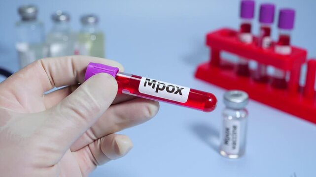Blood collection tubes Mpox test positive results,WHO to rename monkeypox as &lsquo;Mpox&rsquo;
