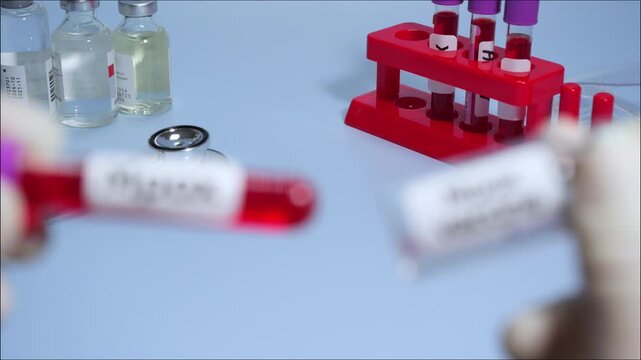 Blood collection tubes Mpox and vaccine,WHO to rename monkeypox as &lsquo;Mpox&rsquo;