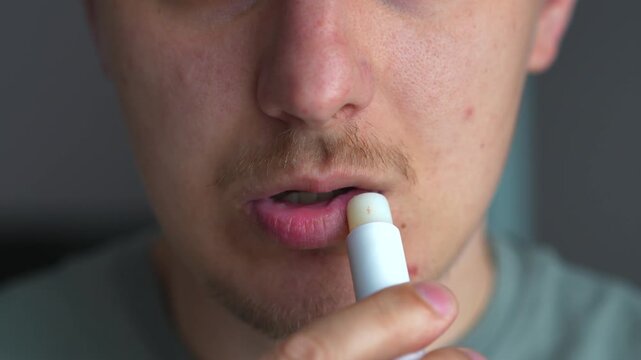 Lipstick.
Dry lips from the cold.
Cracked lips.
Body care