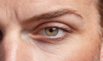 Obraz premium Close-Up View of a Human Eye Featuring Unique Heart-Shaped Pupil in Natural Light