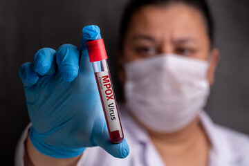 Doctor wearing medical gloves holding a blood tube with positive Monkeypox - Mpox virus Blood Sample.