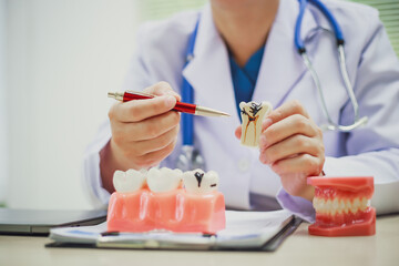 Dentures, dentures in the jaw, root canal treatment, gum disease, tooth models for dentists who are...