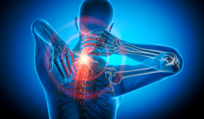 Illustration of a man with strong pain in neck with dark blue background - 3D Illustration