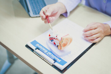 Doctor with human ear anatomy model, ear disease, otitis media, perforated eardrum, Meniere's...