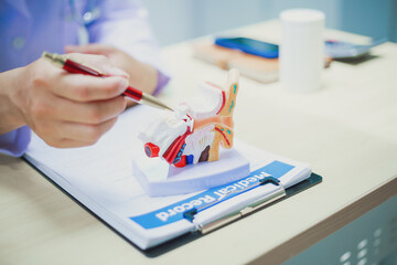Doctor with human ear anatomy model, ear disease, otitis media, perforated eardrum, Meniere's...
