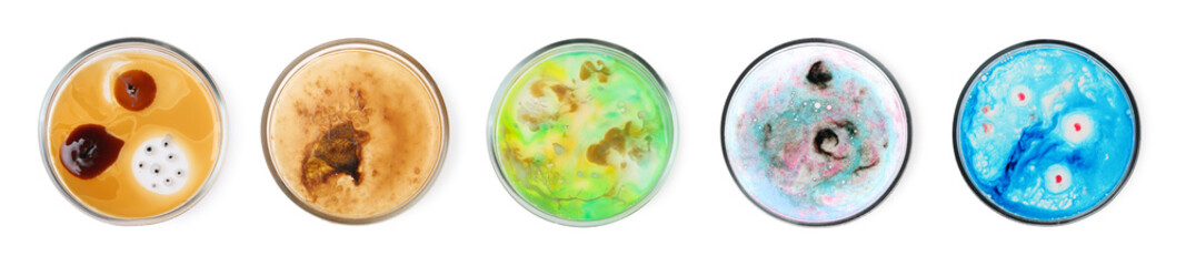 Set of Petri dishes with different bacteria colonies on white background, top view