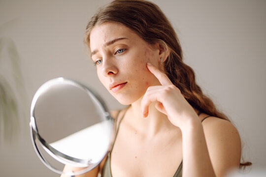Woman worry about her face when she saw the problem of acne occur by a mini mirror. Pimples, acne, pores, scars. Natural skin without filters