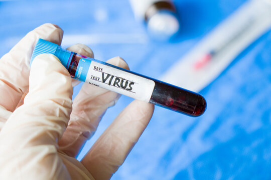 Mpox monkeypox virus