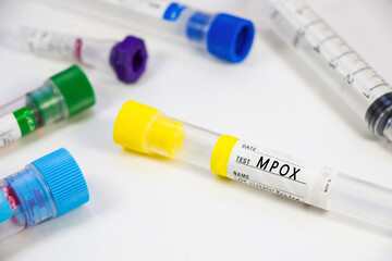 Mpox blood test empty tubes samples on the white background, studio shoot.
