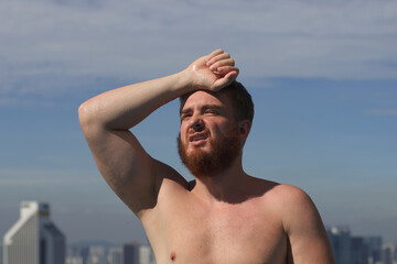 Young man is suffering from heat, having sunstroke at summer day