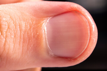 Human thumb close-up on a gray background