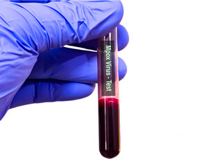 Biological specimens for Monkeypox virus test. It is also known as Moneypox virus, a double-stranded DNA, zoonotic virus and a species of the genus Orthopoxvirus in the family Poxviridae. Blood test