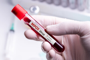 Doctor wearing medical gloves holding a blood tube with positive Monkeypox - Mpox virus Blood...