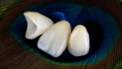 Macro photo on ceramic veneers of central teeth on a bright back