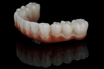 beautiful morphology of a dental prosthesis made of zircon on a black background