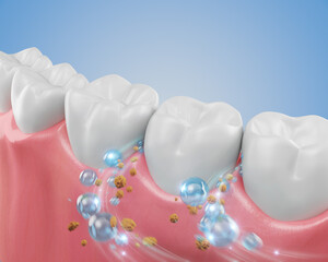 clean teeth remove bacteria, tooth and mouth wash or oral rinse 3d rendering.