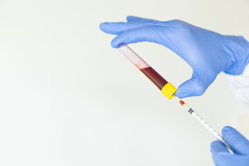 Monkeypox laboratory analysis of a blood sample in a tube, physician draws with syringe and blue gloves on white background with copy space.
