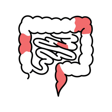 Inflammatory bowel disease color line icon. Autoimmune diseases.