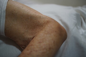 Elderly hands and skin.