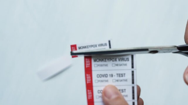 Monkeypox Virus (Maymun &Ccedil;i&ccedil;eği) Test Video, Uskudar Istanbul, Turkiye (Turkey)
