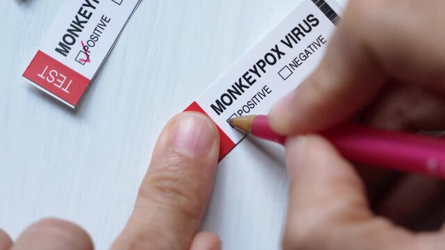 Monkeypox Virus (Maymun &Ccedil;i&ccedil;eği) Test Video, Uskudar Istanbul, Turkiye (Turkey)