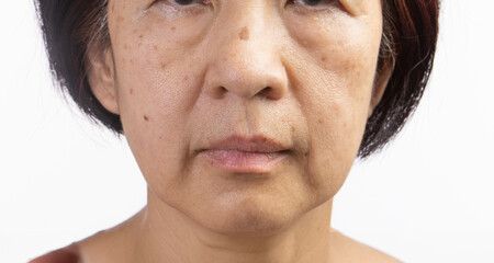 Senior asian woman worry about eye bags and dark spot.