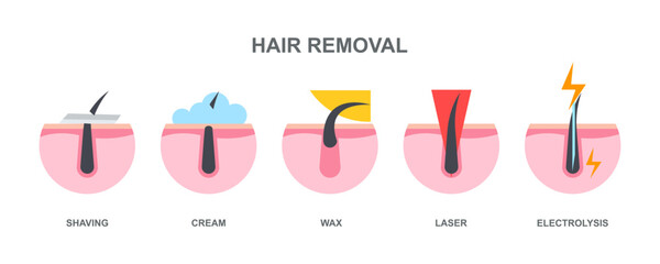 Procedure hair removal, main methods of hair removal: shaving, cream, wax, laser, electrolysis.