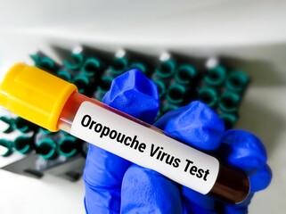 Blood sample for Oropouche virus Test, medical and health concept