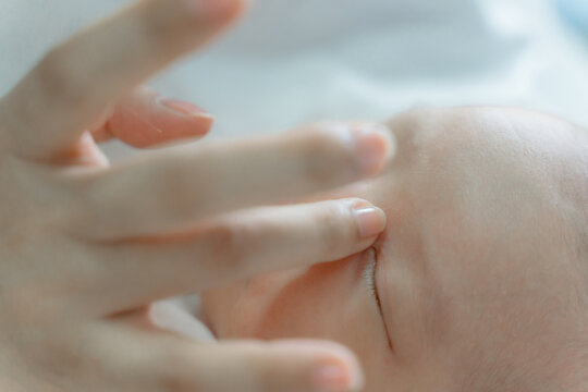 Blocked tear ducts in newborns