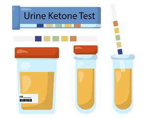acetone test strips and test tubes with urine, urine ketone test