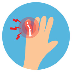 Obraz premium Wrist Bone Fracture Illustration