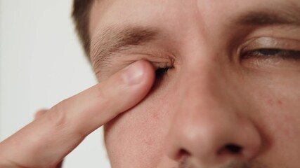 European man rubs eye with his finger and checks it as seen in close up. Eliminates itchy discomfort and debris in eye. Allergic reaction of itching.