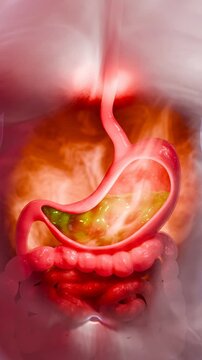 Symptoms of acid reflux or excess acid in the stomach. Gastric juice and intestinal model within the abdominal cavity. Burning sensation in the middle of the chest, acid reflux. 3D Rendering.	