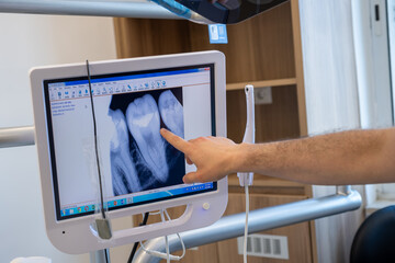 Conversation between dentist and muslim female wearing hijab looking at her tooths x-ray scan on the screen and the doctor is describing her treatment plan to avoid such illness and toothache again