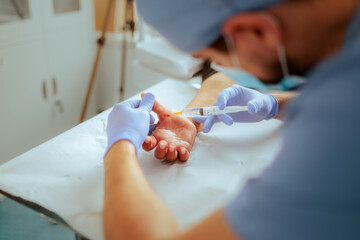 Doctor Injecting the Thumb of a Patient for Surgery. Anesthesiologist  using sedation for surgical procedure preparation 

