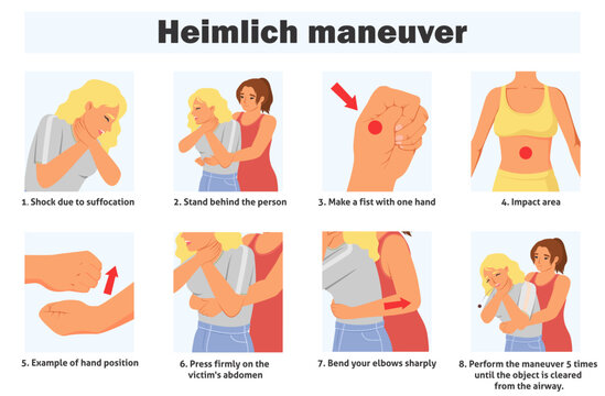 Heimlich maneuver infographic poster with steps of first aid and effective technique to save people life. Two young woman demonstrating emergency procedure vector illustration