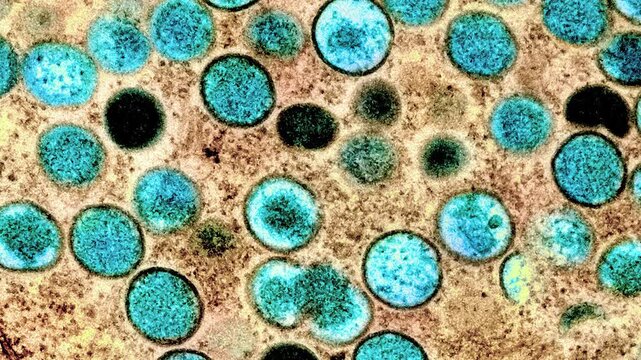 Microscopic illustration of mpox monkeypox virus - Speed zoom in