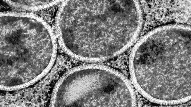 Microscopic illustration of mpox monkeypox virus - Black and white, zoom out
