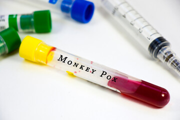 Fototapeta premium Monkey Pox virus
