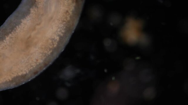 Planarian parasite (flatworm) under microscope view.