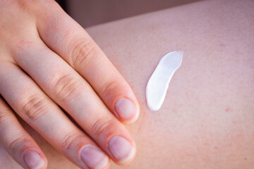 Girl applying cream. SPF cream. Cream texture. Close-up. Moisturizing cream. Beach time. Rest. Relaxation