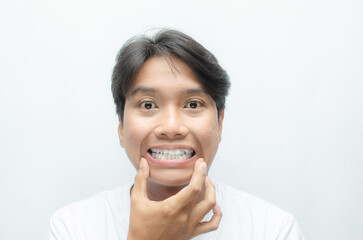 young asian man smiling and showing his crooked teeth isolated over white background. dracula teeth...