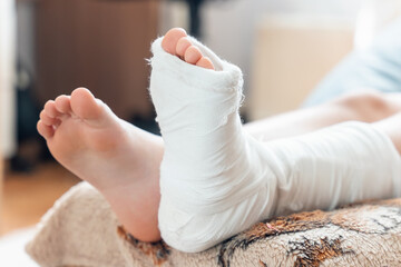 Children's legs, one leg is broken and in a cast