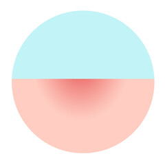 mpox, monkey pox disease. stage 1 macule of Mpox skin symptom