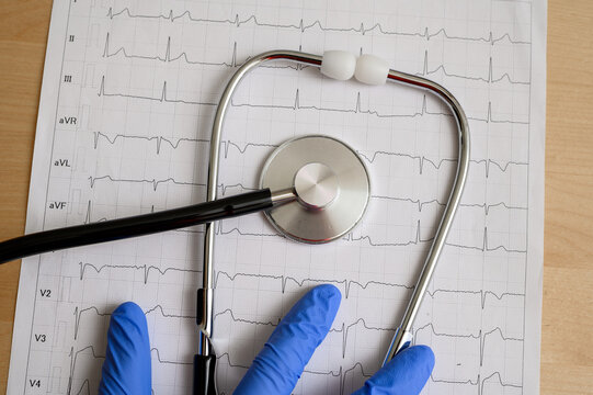 Lekarz odczytuje wynik badań kondycji serca u sportowca, medycyna sportowa 