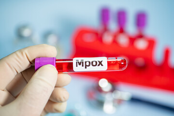 Blood collection tubes monkeypox test positive results,WHO to rename monkeypox as ‘MPOX’