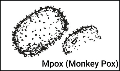 Monkeypox new disease dangerous over the world. Patient with Monkey Pox. Painful rash, red spots blisters on the hand. Close up rash, human hands with Health problem. Banner, copy space. Dengue fever