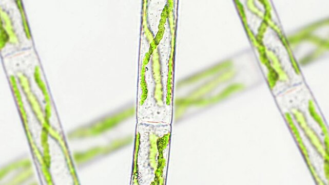 Spirogyra sp. green algae under microscopic view - Chlorophyta